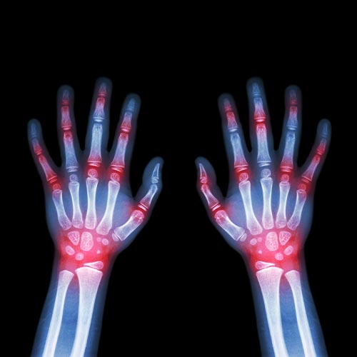 hand arm elbow joint wrist shoulder physical therapy kalispell flathead valley orthopedic